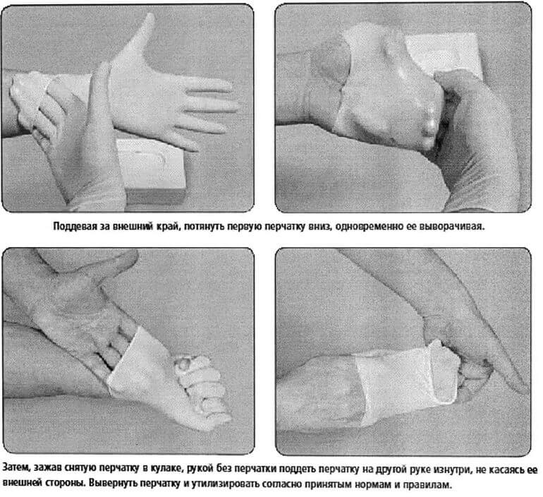 medical gloves 04
