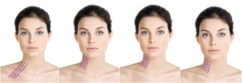 institut esthederm esthelift 14 mk