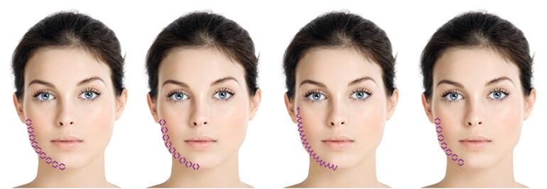 institut esthederm esthelift 15 mk