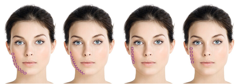 institut esthederm esthelift 16 mk