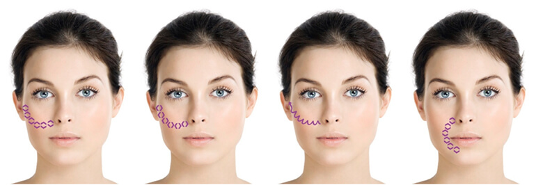 institut esthederm esthelift 18 mk