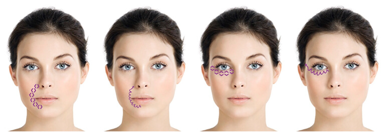 institut esthederm esthelift 19 mk